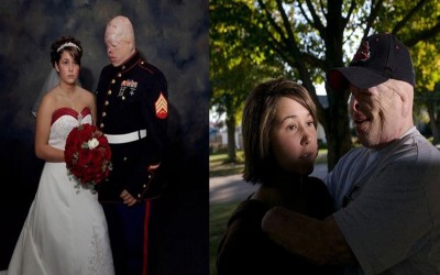海陸戰軍毀容卻如願與女友完婚  大家一看照片卻發現「怪怪的」隔年果然離婚了...（9P）