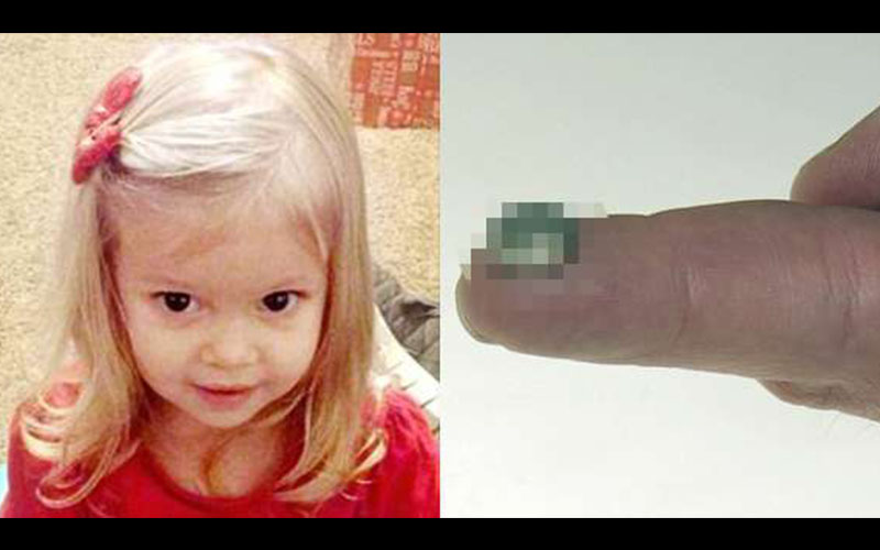 兩歲女孩突然吐血臉色發青兩天後死亡，直到最後才在她胃部發現了這個只有1公分的致命物