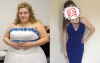 曾經重達146公斤的她在做了這個手術後成功甩掉88公斤，E乳超美模樣讓人噴鼻血