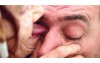 80歲老婦自稱舌療師「舌舔眼球」至今已經治癒5000多人