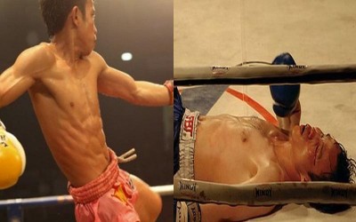這個泰國拳手為了贏得比賽，竟不擇手段的在體內植入兇器