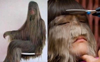 世界上體毛最長的「猩猩女」除去身上毛髮後，是個美人胚子